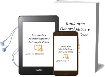 Descargar AudioLibro Implantes Odontologicos y Patología Osea de Carlos M. Piccinini año 2012