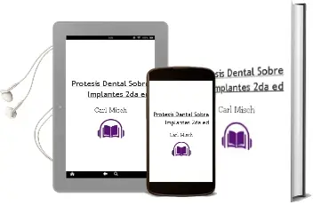Descargar AudioLibro Protesis Dental Sobre Implantes, 2Da. ed. de Carl Misch año 2015