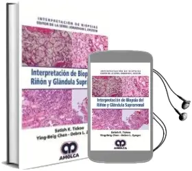 Descargar AudioLibro Interpretacion de Biopsia del Riñon y Glandula Suprarrenal  de S. Chen, Y. Zynger, D. Tickoo año 2018