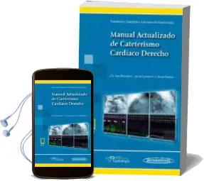 Descargar AudioLibro Manual Actualizado de Cateterismo Cardíaco Derecho (Libro + Ebook ) de J.A. San Roman año 2018